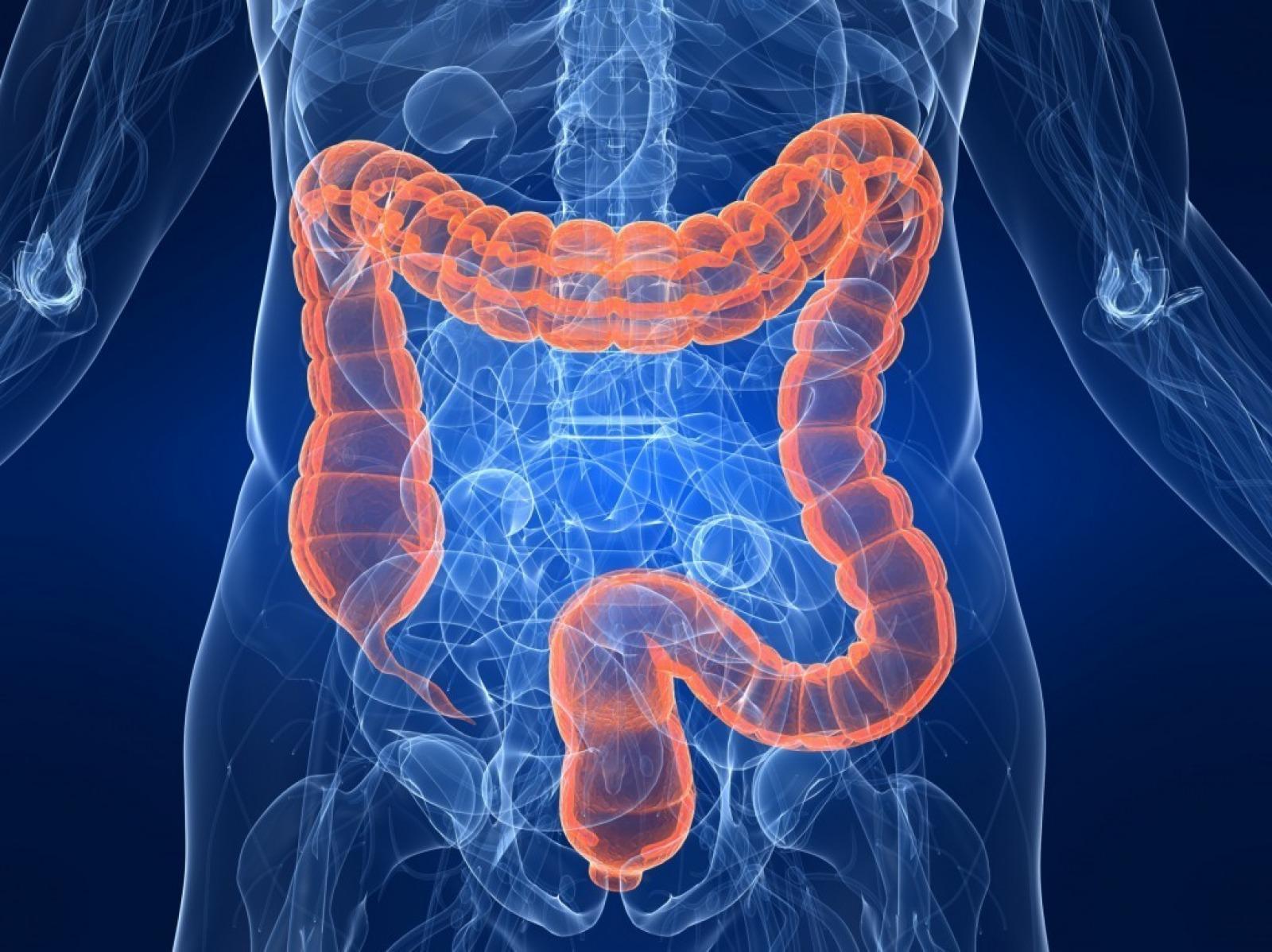 O QUE É DISBIOSE INTESTINAL ?